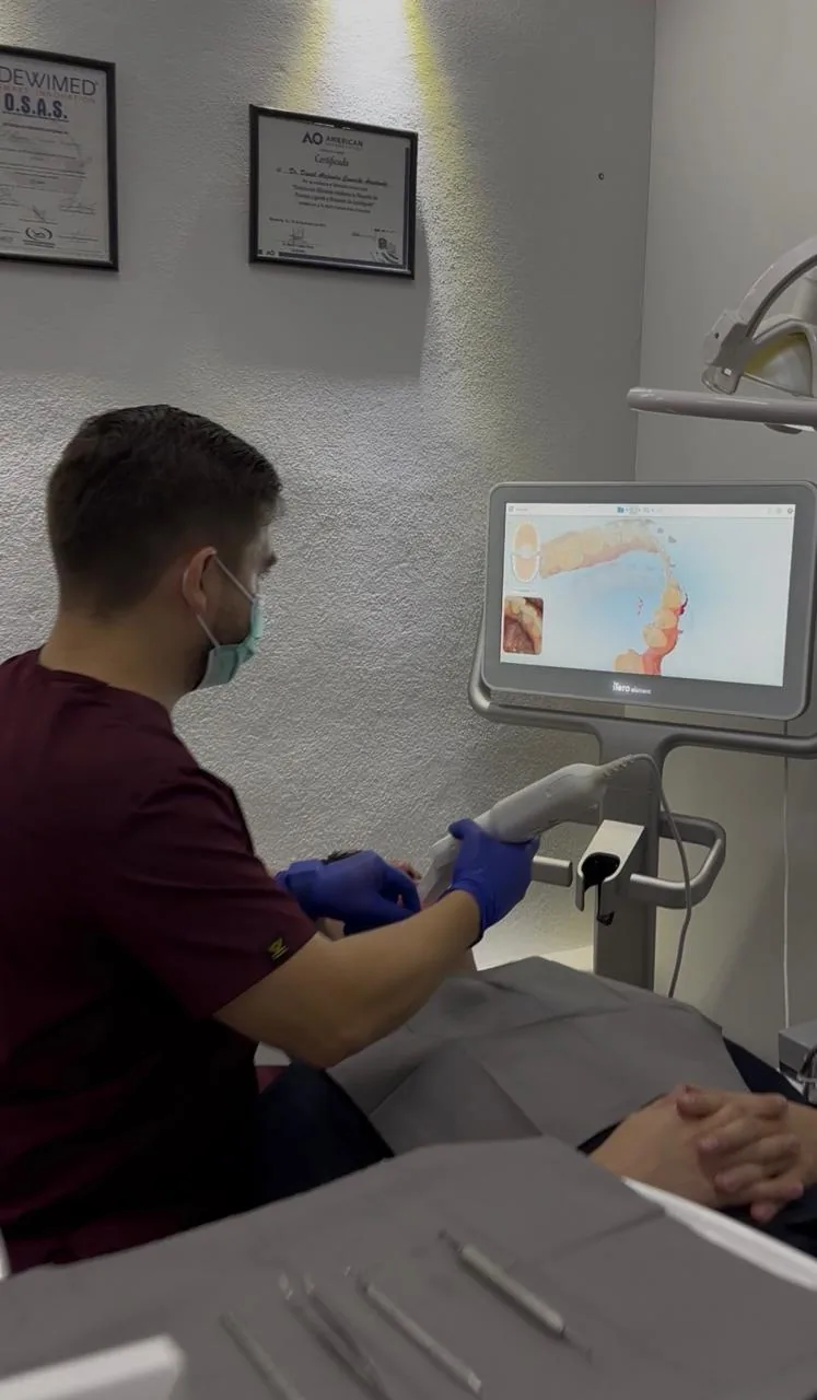 Escaneo intraoral para la planeación de carillas